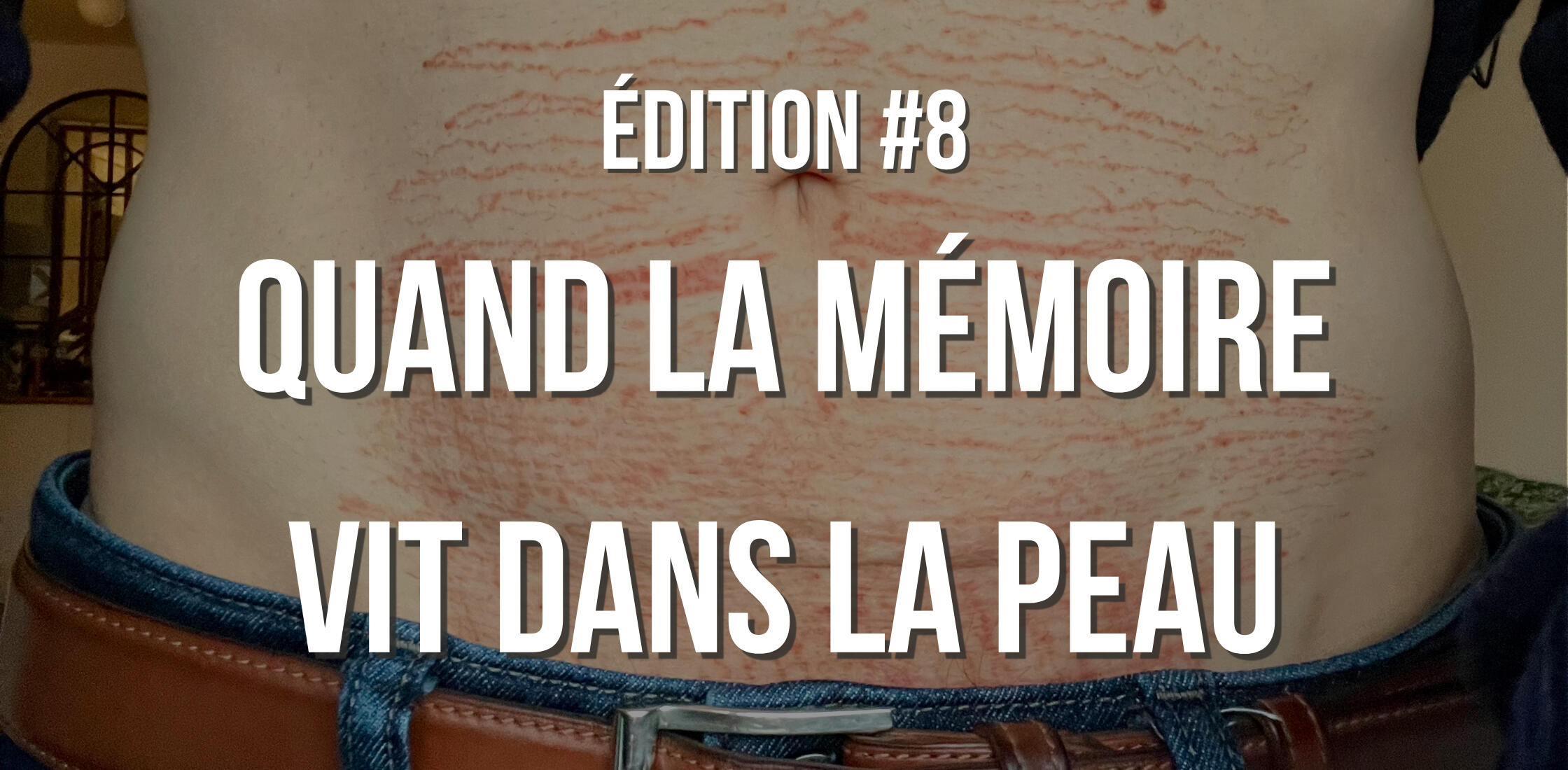 Quand la mémoire vit dans la peau Quand la mémoire vit dans la peau